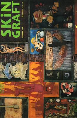 Skin Graft