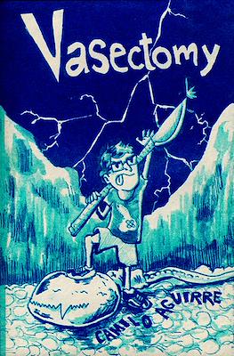 Vasectomy